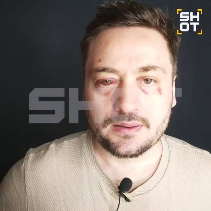 В Москве актёра Руслана Алдонина избили возле бара и украли сумку qkhiqhidzkiqxxkmp